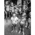 Starving-Biafran-kids-4