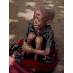 starving-biafran-child-3